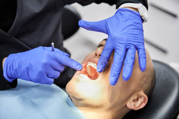 Best Emergency Wisdom Teeth Removal in Godley, TX