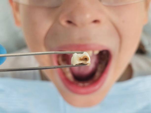 Best Walk-In Emergency Dentist in Godley, TX